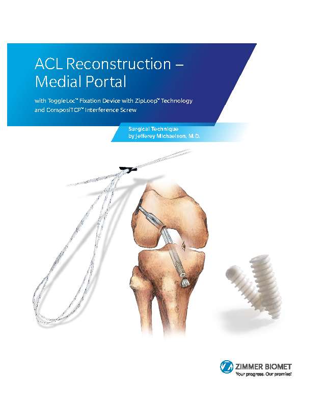 ACL Reconstruction – Medial Portal